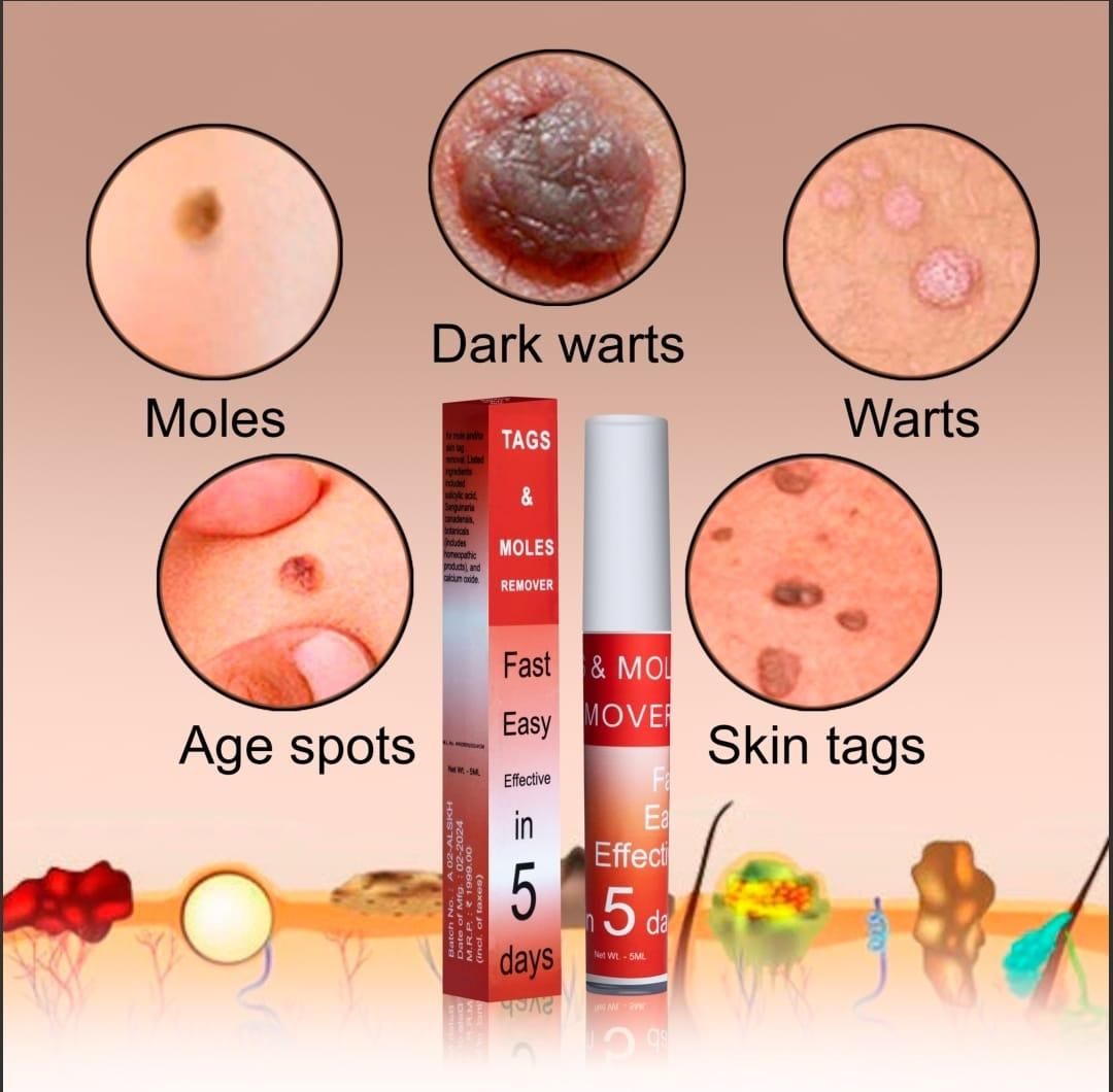TAGS & MOLES REMOVER