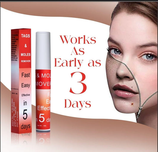 TAGS & MOLES REMOVER